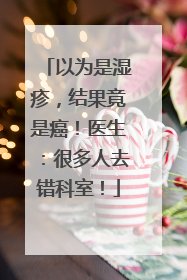 以为是湿疹，结果竟是癌！医生：很多人去错科室！